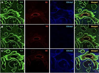 Expression of extracellular matrix components in the meibomian gland